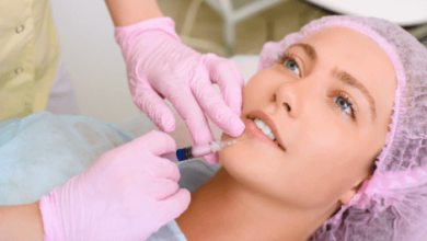 Dermal Fillers