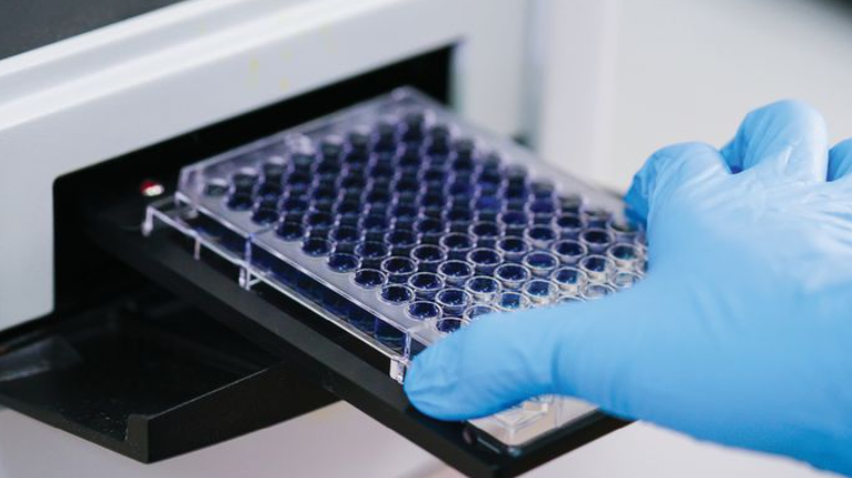 ELISA Plate Reader: A Complete Guide to How It Works and Why It Matters